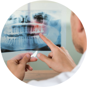 implantologia dental Monterrey