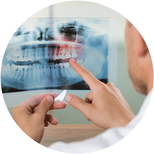 implantologia dental Monterrey