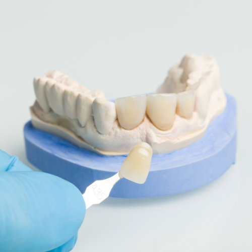 Tratamientos Dentales en Monterrey | Regiodental