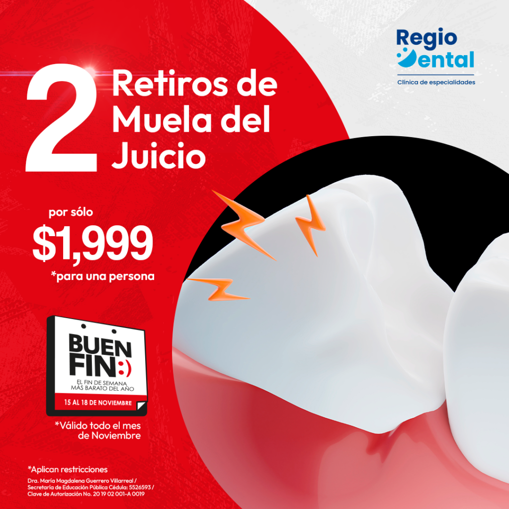 2x1 en Extracciones de Muela de jucio con nuestra promoción dental de buen fin