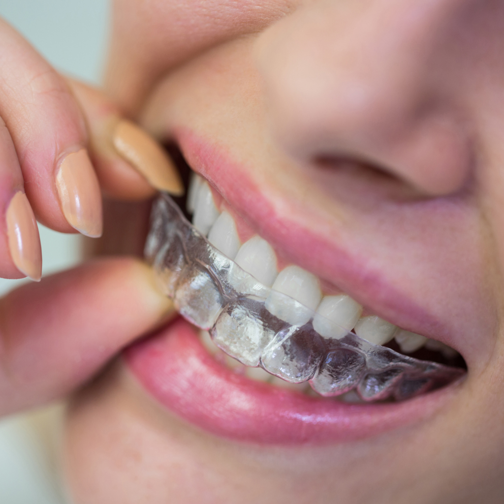 Paquetes y Membresías Dentales | Regiodental